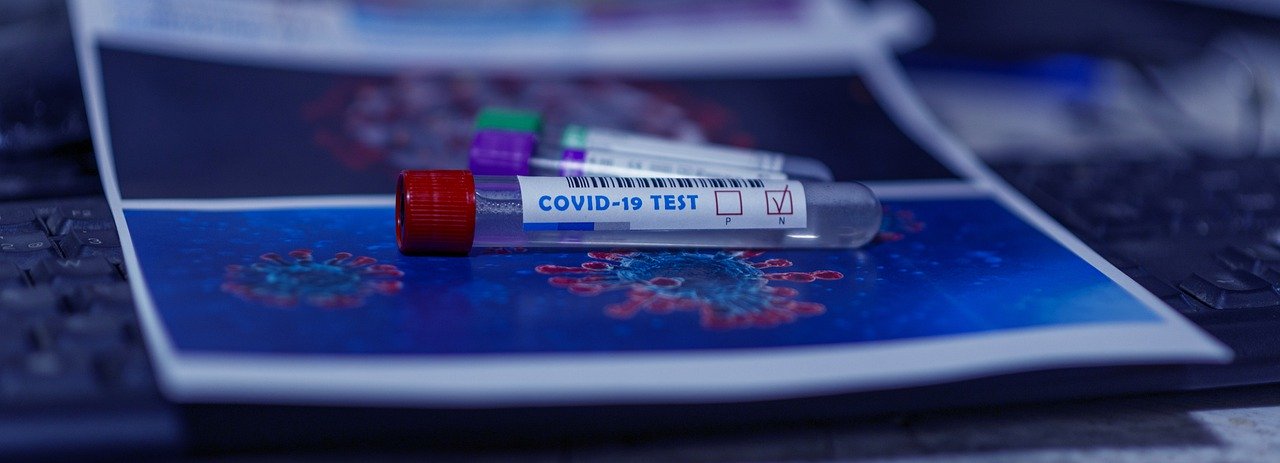 Studio Notícias | Studio TV Testes para COVID-19 estão sendo oferecidos por laboratórios e farmácia de Veranópolis