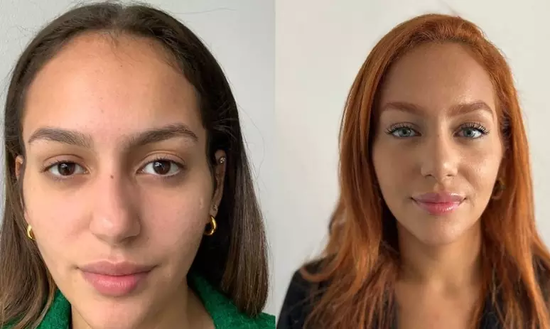 Studio Notícias | Studio TV Brasileira viraliza após mudar cor dos olhos com procedimento irreversível