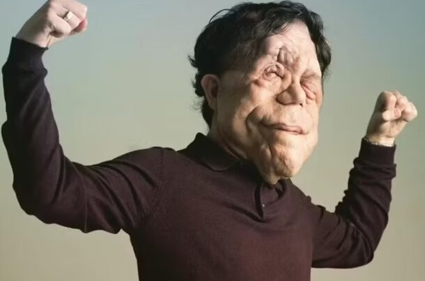 Adam Pearson: superação e destaque no cinema com doença rara 1 Studio Notícias | Studio TV Adam Pearson: superação e destaque no cinema com doença rara