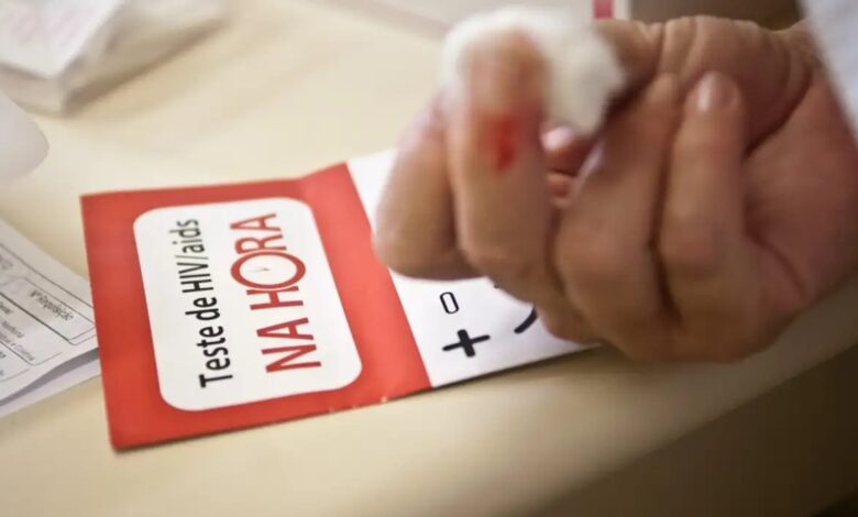 Studio Notícias | Studio TV Aids: Brasil tem alta de casos, mas menor mortalidade desde 2013