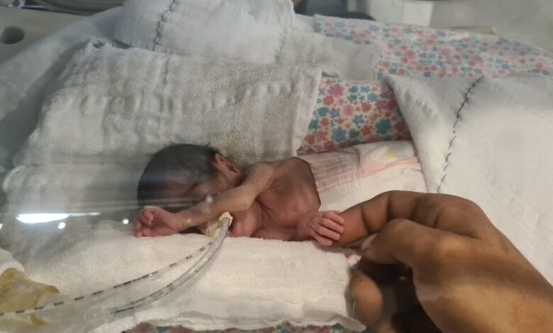 Studio Notícias | Studio TV Bebê com menor peso já nascido no Hospital de Clínicas recebe alta após quatro meses de luta