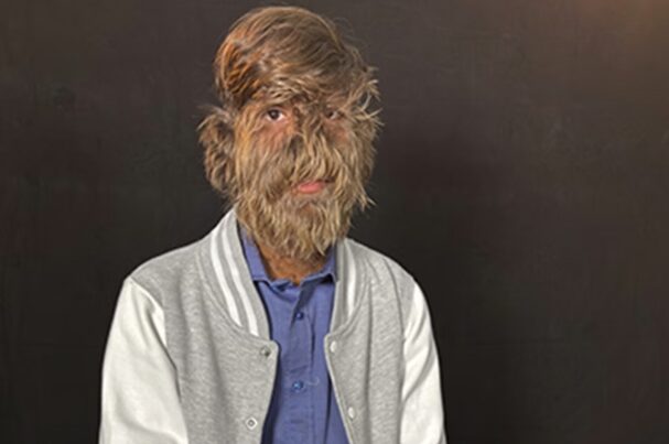 Studio Notícias | Studio TV Indiano bate recorde como homem mais peludo do mundo e surpreende com sua história