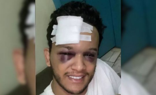 Cantor Hugo, da dupla com Raphael, sofre acidente grave e se recupera em casa 1 Studio Notícias | Studio TV Cantor Hugo, da dupla com Raphael, sofre acidente grave e se recupera em casa