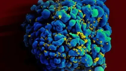 HIV: dois casos de cura do vírus são anunciados - Studio TV