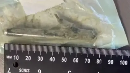 Paciente sofre infecção e passa por cirurgia após hospital não identificar madeira de 8 cm em SC - Studio TV