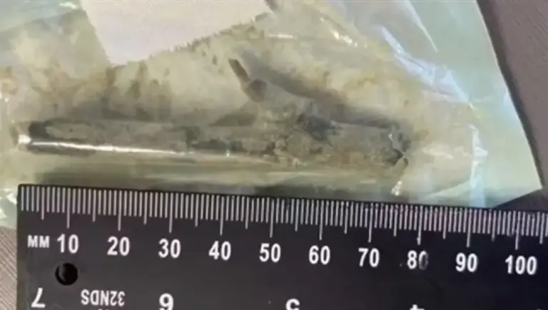 Paciente sofre infecção e passa por cirurgia após hospital não identificar madeira de 8 cm em SC - Studio TV