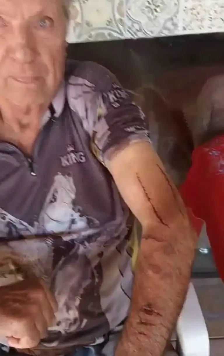 Agricultor de 76 anos sobrevive após ataque de onça-parda no Paraná - Studio TV