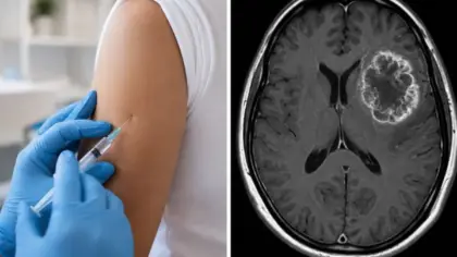 Vacina experimental contra tumor cerebral impede retorno do câncer em 42% dos pacientes - Studio TV