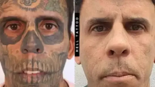Tumor é descoberto antes de sessão de remoção de tatuagens de gaúcho e procedimento é adiado - Studio TV