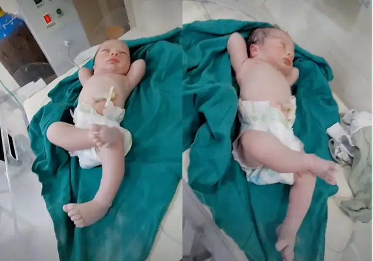 Bebê viraliza ao nascer com pose de milionário e diverte equipe médica - Studio TV