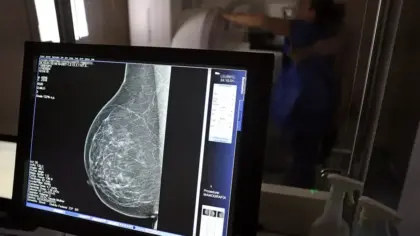 Planos de saúde terão que cobrir mamografia digital para todas as idades a partir de outubro - Studio TV