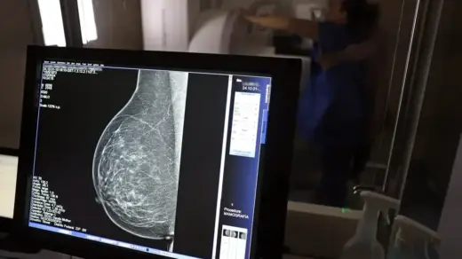 Planos de saúde terão que cobrir mamografia digital para todas as idades a partir de outubro - Studio TV
