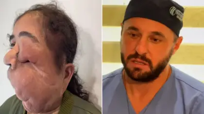 Imagem da matéria sobre Paula Raissa e o atendimento pelo Projeto Leozinho