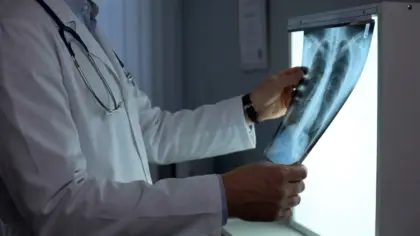 Anvisa aprova novos medicamentos para tratamento de câncer de pulmão e de mama no Brasil - Studio TV