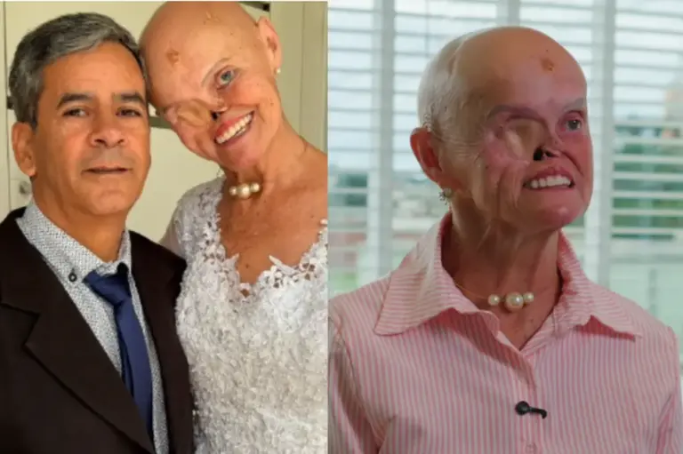Após enfrentar 73 casos de câncer, mulher se casa com homem que conheceu durante tratamento - Studio TV