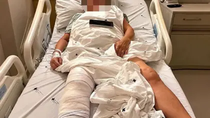 Idosa de 72 anos é operada no joelho errado e recebe prótese no lado que não precisava - Studio TV
