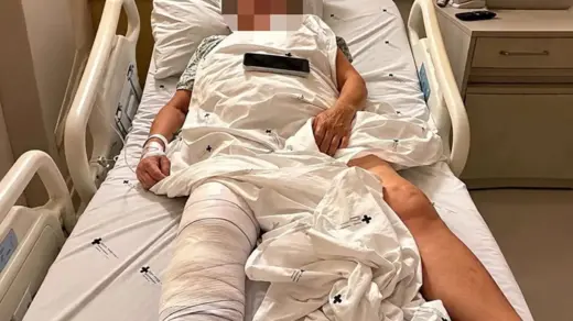 Idosa de 72 anos é operada no joelho errado e recebe prótese no lado que não precisava - Studio TV