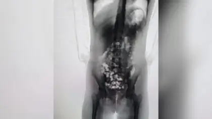 Mãe é presa após scanner identificar 32 porções de droga escondidas no corpo da filha de 13 anos em SC - Studio TV