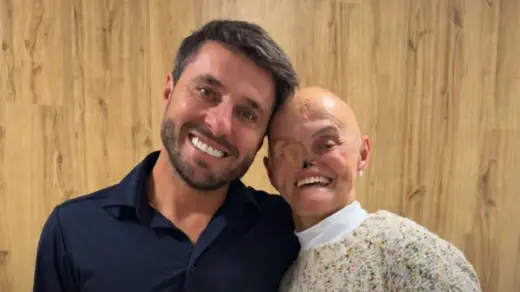 Mulher que enfrentou 73 tumores de pele receberá tratamento para reconstrução facial em Santa Catarina - Studio TV